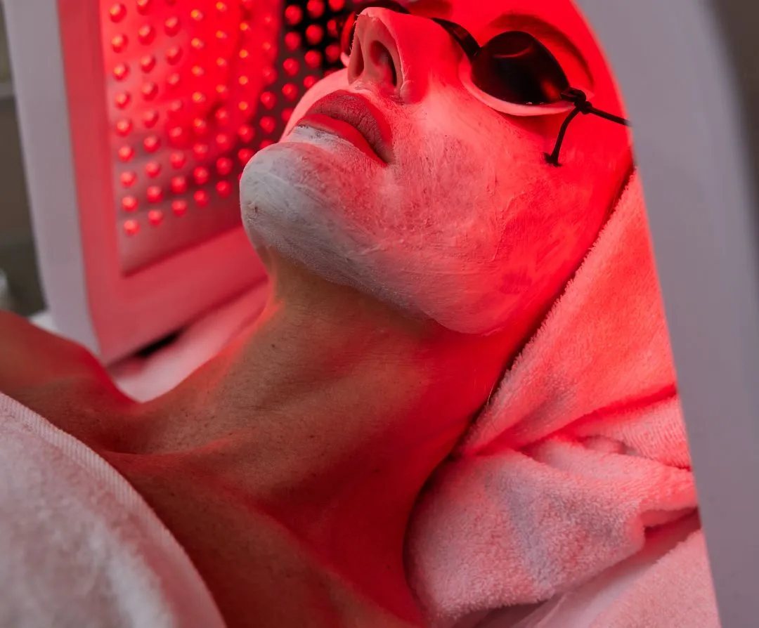 Pimples Removal Facial in Jaipur