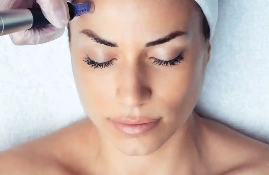 Microdermabrasion-Microneedling-Treatment-Service-in-Jaipur