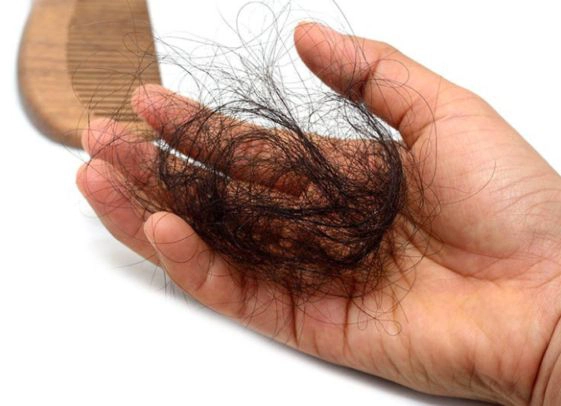 Hair Fall Treatment in Malviya Nagar Jaipur